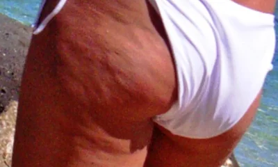 Combattere la cellulite a tavola