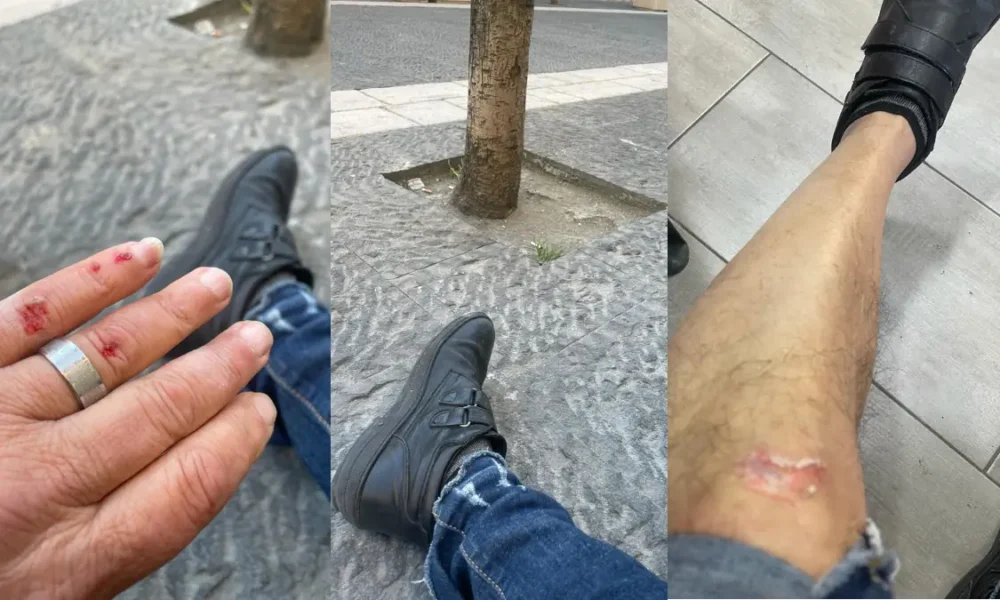 Inciampa nell'invaso di un albero