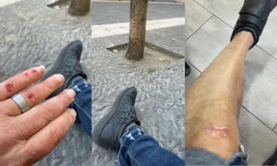 Inciampa nell'invaso di un albero