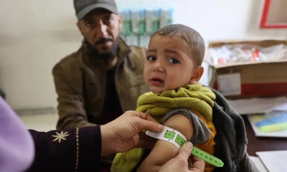 Unicef FAO WFP - malnutrizione Gaza