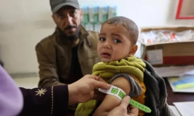 Unicef FAO WFP - malnutrizione Gaza