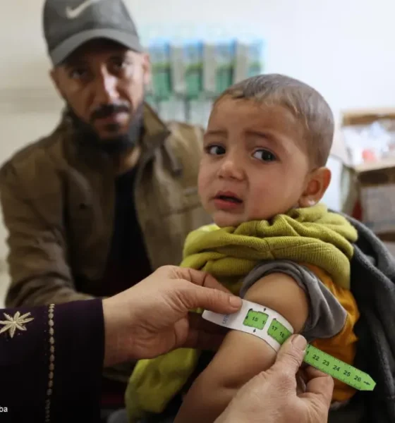 Unicef FAO WFP - malnutrizione Gaza