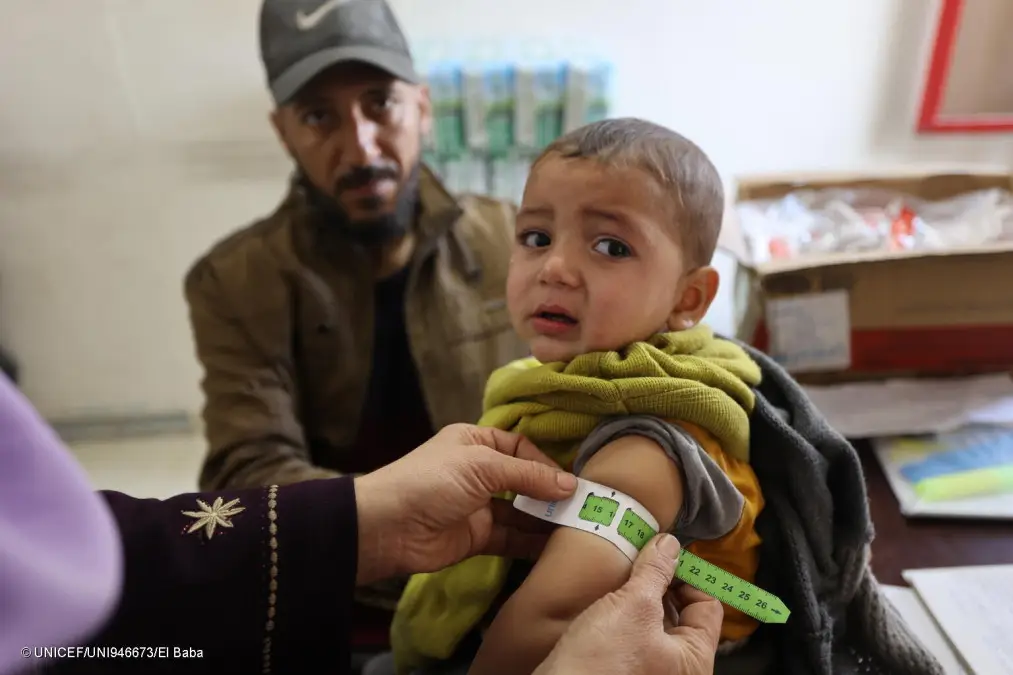 Unicef FAO WFP - malnutrizione Gaza